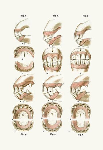 Teeth Plate Description 28x42 Giclee on Canvas